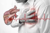 Ông Hoàng Nam Tiến đột ngột qua đời: Cảnh báo biến cố tim đe doạ cả người khoẻ mạnh