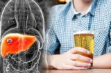 Uống cốc nước này tưởng lành mạnh nhưng đang phá nát gan, ngon mấy cũng đừng tiếc