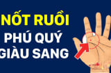 5 nốt ruồi trên tay Ăn May Cả Đời, có 1/5 cũng sướng