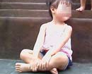 Vụ bé 2 tuổi nghi bị xâm hại tại trường: Gia đình gửi đơn kiến nghị