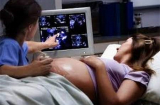 Canxi hóa rau thai có nguy hiểm?