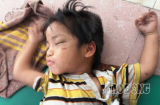 Bé 3 tuổi bị bạo hành: Cơ quan chức năng nói gì?