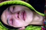 Thanh niên nhập viện vì bị CSGT chọc gậy vào mặt