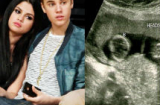 Selena Gomez có thai song sinh với Justin Bieber?