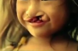 Nụ cười bé gái hở hàm ếch trong thước phim cảm động