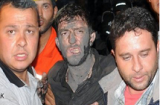 Ít nhất 157 người chết sau vụ nổ mỏ than ở Thổ Nhĩ Kỳ