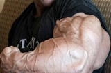 Kinh hãi bắp tay bị biến dạng khi lạm dụng steroid