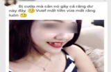 Cô gái vô tư chụp ảnh khoe chiến tích 'cắn tên cướp nên bị mất răng'