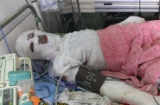 Nổ bình gas ở Hà Nội: Gia đình nạn nhân lâm vào cảnh cùng quẫn