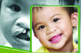 Hơn 5000 trẻ em Việt Nam khuyết tật môi có cơ hội phẫu thuật