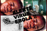 Đại dịch Ebola: Sẵn sàng đối phó khi dịch bệnh xuất hiện