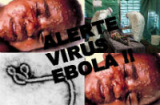 Đại dịch Ebola: 90% cái ch.ết bắt nguồn từ đâu?