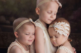 Xúc động bộ ảnh 3 bé gái ung thư đang bao bọc nhau