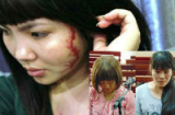 “Hoạn thư” lĩnh án tù vì xăm rết lên mặt thiếu nữ