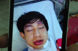 Ca sĩ nhóm nhạc HKT bị tai nạn nghiêm trọng