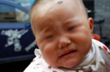 Xót xa bé gái 11 tháng tuổi bị mọc kim sắt khắp người