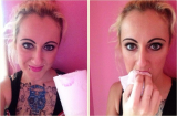 Sản phụ 5 con nghiện ăn giấy vệ sinh khi ốm nghén