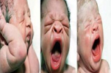 Trẻ sơ sinh mới chào đời: 'sốc' vì quá xấu