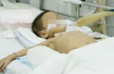 Mẹ bất cẩn, bé gái 2 tuổi suýt chết vì uống thuốc diệt cỏ