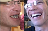 Vị khách hào phóng boa nhân viên 500 triệu để thẩm mỹ răng
