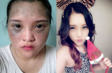 'Soi' độ lột xác của 10 thiếu nữ Việt sau khi dao kéo