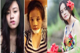 3 hotgirl Việt dám công khai quá trình thẩm mỹ nhiều đau đớn