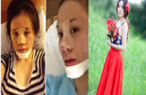 Bà Tưng và Angela Phương Trinh 'đổi đời' nhờ phẫu thuật thẩm mỹ
