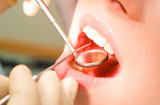 Hàng chục nghìn người có thể bị nhiễm HIV khi đi chữa răng