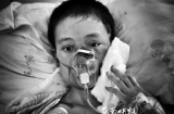 Kinh hoàng: Cô gái xinh đẹp tử vong vì hàng trăm con giòi ký sinh