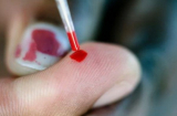 Mẹo xử lý khi không may có nguy cơ bị phơi nhiễm HIV