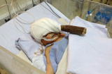 Bé trai sơ sinh bị đâm xuyên sọ lúc nửa đêm trong bệnh viện