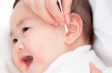 Lấy ráy tai cho trẻ thường xuyên - nên hay không nên?