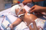 Vụ bé sơ sinh bị đâm xuyên sọ: 'Đừng bỏ cuộc con nhé!'