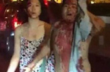 Những hình ảnh kinh hoàng về vụ nổ ở Thiên Tân