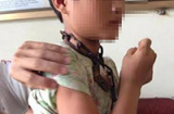 Nghệ An: Phát hiện bé trai cổ bị khóa xích, tinh thần hoảng loạn