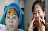 Quá trình thẩm mỹ đầy đau đớn của cô gái 'ngại' make up