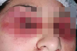 Kinh hoàng: Thiếu nữ bị gia đình móc mắt dã man
