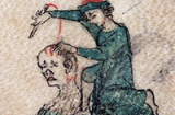 Phát hoảng với cách chữa bệnh đáng sợ thời Trung Cổ
