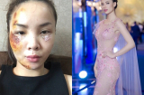 Showbiz Việt ngày 18/9: Yến Trang sexy sau tai nạn, Hồng Quế 'hở'