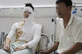 Hà Nội: Nam sinh bị tạt axit ngay giữa đường