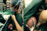 Nữ y tá vừa phẫu thuật vừa cho bú trên bàn mổ gây xúc động
