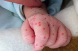 Những ổ dịch bệnh sốt xuất huyết ngay trong nhà mẹ cần biết ngay