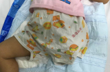 Phụ huynh bất cẩn, bé gái bị nghiền nát chân trong máy xay ở HN