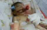Xót xa bé 4 tháng tuổi bị chuột cắn đến chết vì mẹ để ngủ 1 mình