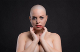 Người mẫu 'siêu vòng 3' bị ung thư vẫn nghiện thẩm mỹ