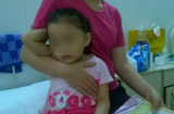 Côn đồ tr.uy s.át cả gia đình, bé 3 tuổi bị chém đứt gân chân