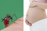Không phải cứ nhiễm virus Zika là sẽ sinh con bị dị tật đầu nhỏ