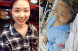 Nữ sinh bị tạt axít ở Sài Gòn viết tâm thư xót xa trên Facebook
