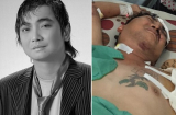 Xót thương ca sỹ Việt bị mất một cánh tay vì tai nạn giao thông