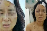 Nguyên nhân khiến cô giáo bị chồng đánh đập dã man ở Phú Thọ